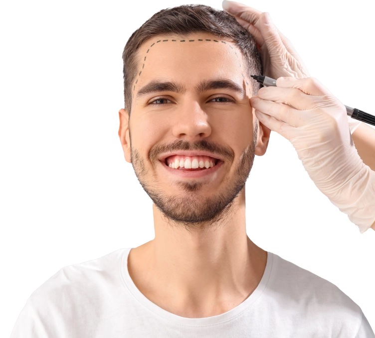 FUE Hair Transplant