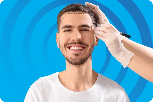 FUE Hair Transplant