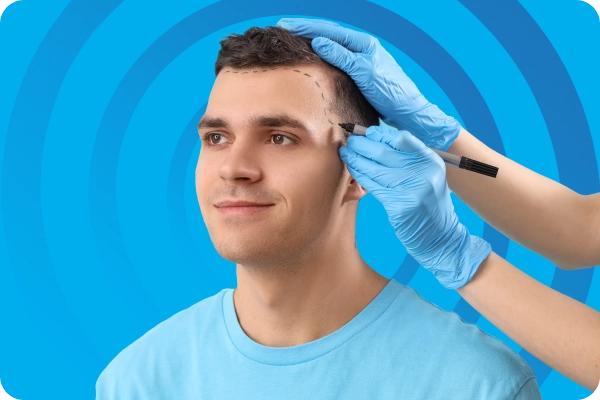 Sapphire FUE Hair Transplant